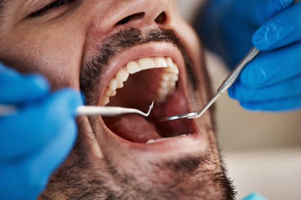 Best Emergency Treatment for Toothache in Edgerton, KS