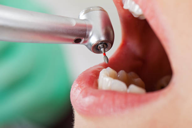Best After-Hours Emergency Dentist in Edgerton, KS